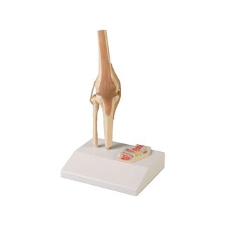 Miniature knee joint with cross section
