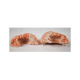 8-split brain with arteries in split head
