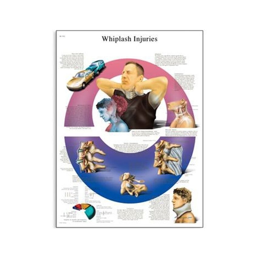 Whiplash injury 50x67 cm