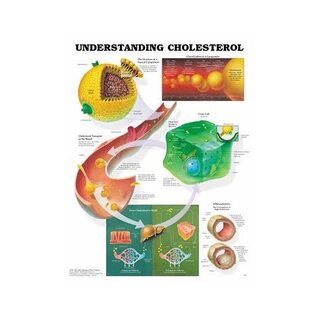 Understand cholesterol laminated poster 51x66 cm