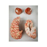 8-split brain with arteries in split head