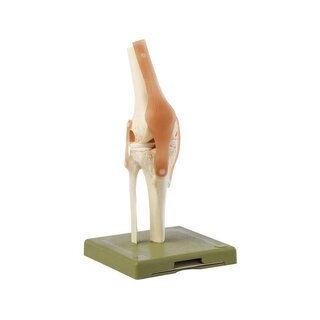 Functional knee joint