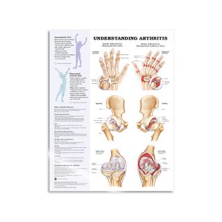 Arthritis laminated English