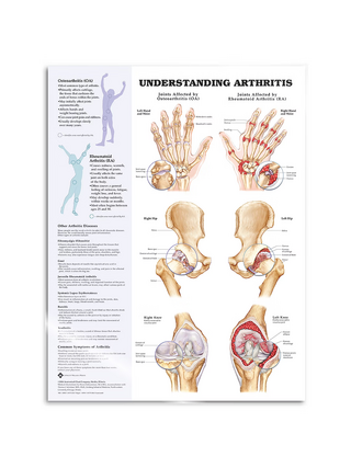 Arthritis laminated English