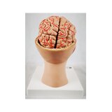 8-split brain with arteries in split head