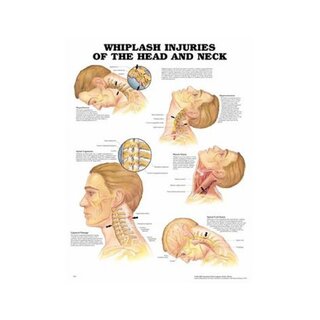 Whip wound damage laminated poster English