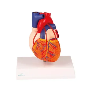 Heart with bypass