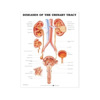 Urinary tract diseases English in high-gloss PET plastic film