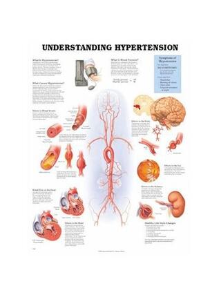 Understanding High Blood Pressure Laminated Poster 51x66 cm