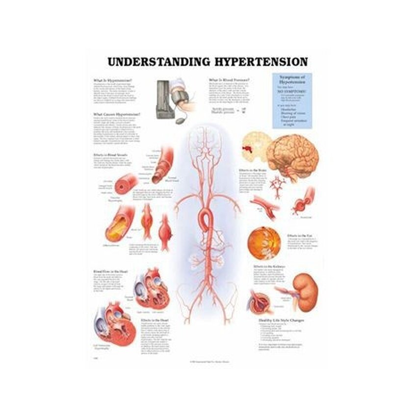 Understanding High Blood Pressure Laminated Poster 51x66 cm