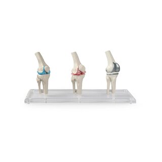 Knee implant model