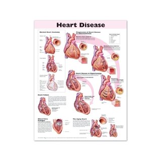 Laminated poster on heart disease in English