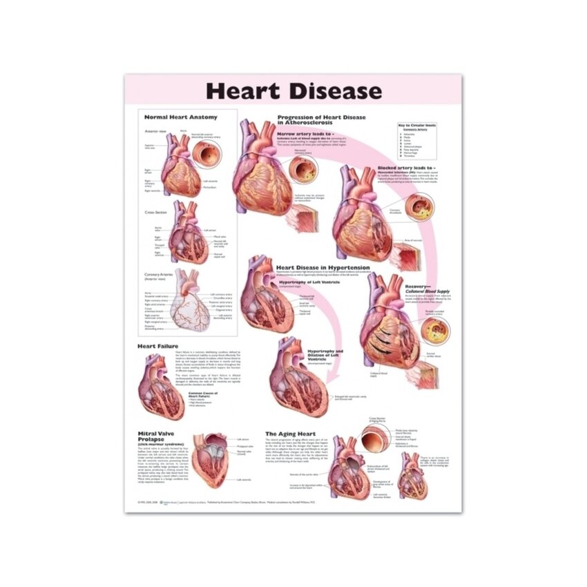 Laminated poster on heart disease in English