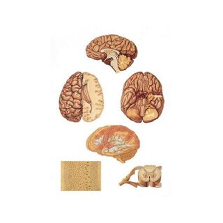 Central nervous system 84x200 cm