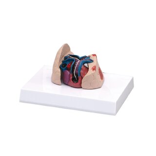 Cat heart and lung model with heartworm