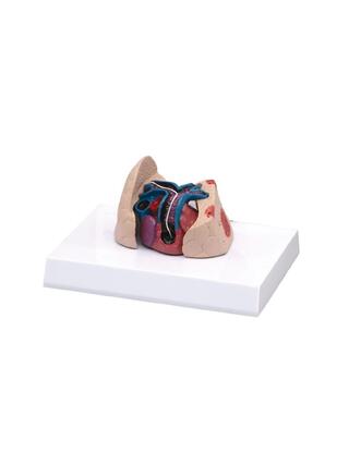 Cat heart and lung model with heartworm