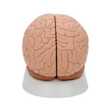 Classic brain real cast