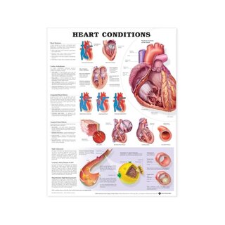 Heart disease laminated poster