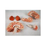 8-split brain with arteries in split head