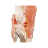 Functional knee joint