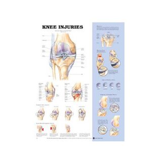 Knee injuries poster English