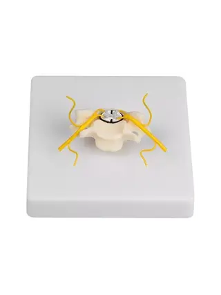 Vertebra with spinal cord section