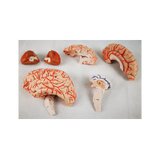 8-split brain with arteries in split head