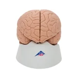 Classic brain real cast