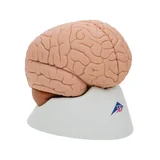 Classic brain real cast