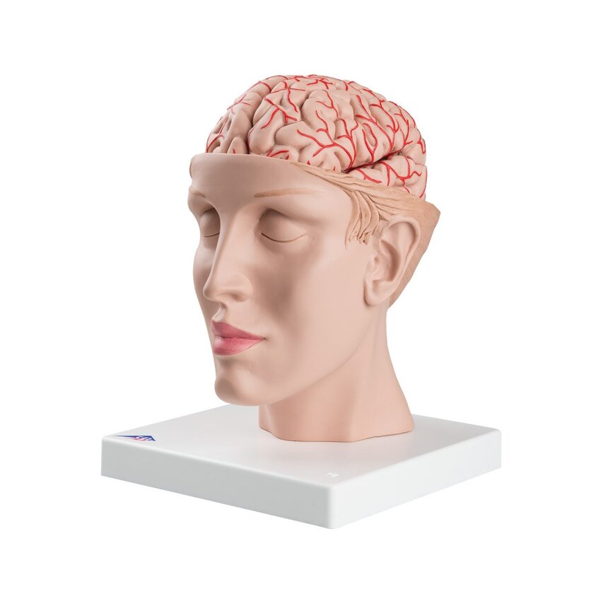 8-split brain with arteries in split head