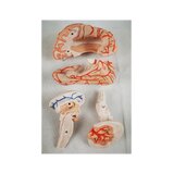 8-split brain with arteries in split head