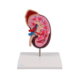 Enlarged kidney model incl. adrenal gland showing a longitudinal section of the kidney