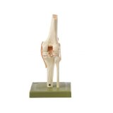 Functional knee joint