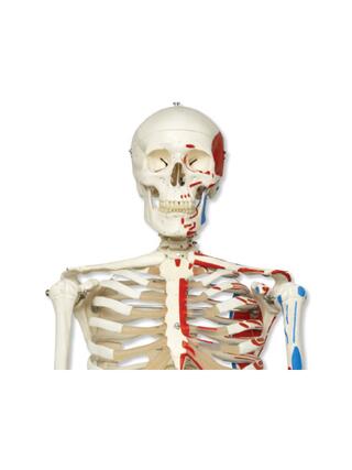 3B Scientific - Skeleton with muscle markings