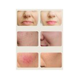 Infrared LED face mask SweHealth