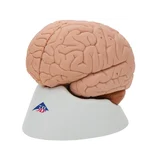 Classic brain real cast