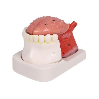 Tongue and teeth model, life size, 4-part