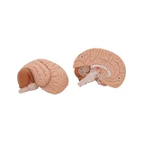Classic brain real cast