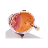 Half of the eye, enlarged
