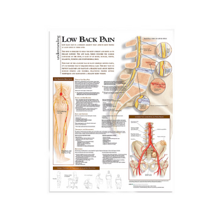 Low back pain laminated poster in English