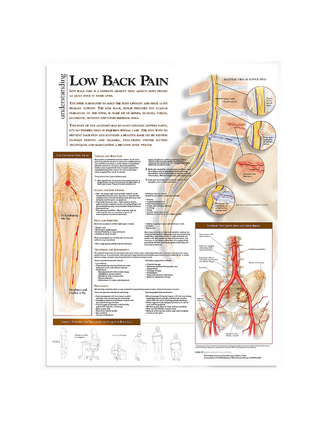 Low back pain laminated poster in English
