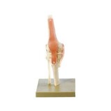 Functional knee joint