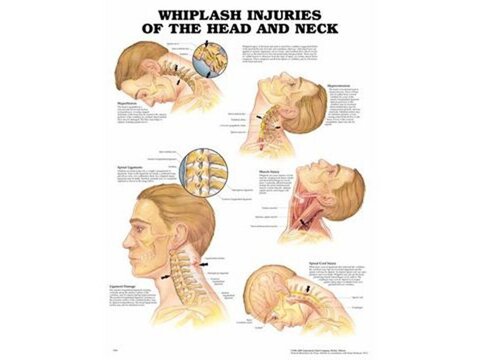 Posters about musculoskeletal diseases