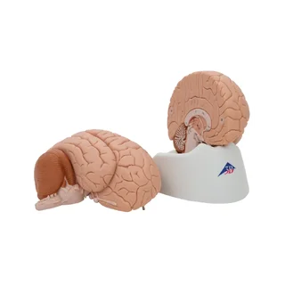 Classic brain real cast