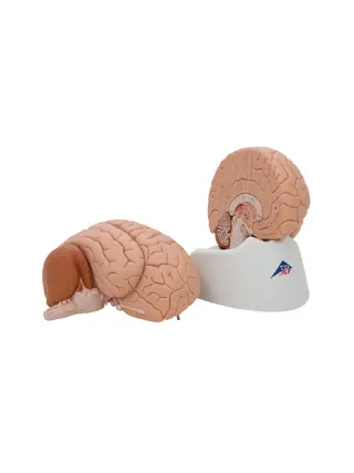 Classic brain real cast