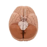 Classic brain real cast