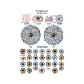 Diagram Iris diagnosis anatomy board 50x70cm