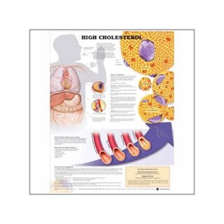 Too high cholesterol laminated poster with the ring holes